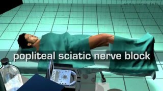 Popliteal Sciatic Nerve Block [upl. by Namyac]