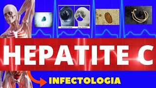 HEPATITE C  CARACTERÍSTICAS SINTOMAS DIAGNÓSTICO E TRATAMENTO  INFECTOLOGIA [upl. by Jule299]