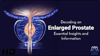 Enlarged Prostate Explained Symptoms Causes and Treatments [upl. by Harrad]