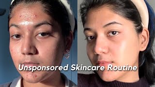 How I got rid of my ACNE SCARS amp TEXTURE  My Unsponsored Skincare Routine 🧴🫧🧖 [upl. by Gabriello]