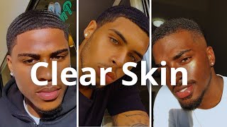 How To Get Clear Skin Naturally [upl. by Mozes]