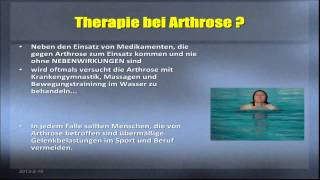 Hausmittel gegen Arthrose [upl. by Kronfeld120]