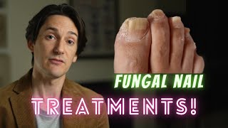 Fungal Nail Treatments [upl. by Nnylacissej498]