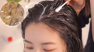 ASMR 시원한 두피 마사지스케일링빗질  Scalp Massage and Scalp Scaling [upl. by Kannan807]