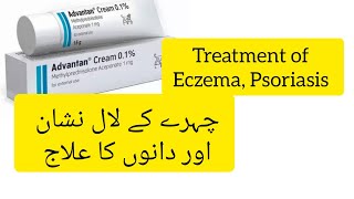 Advantan cream Advantan cream uses Advantan cream benefits in urdu Skin Inflammation ka Ilaaj [upl. by Dombrowski22]