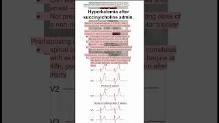 Hyperkalemia after succinylcholine admin [upl. by Wiskind]