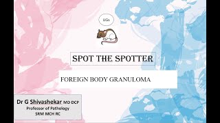 FOREIGN BODY GRANULOMA UG SPOTTERS  RATS  MBBS SRMMCM RC  Dr GSS [upl. by Nelyag]