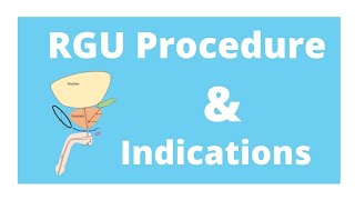 RGU procedure amp its indication [upl. by Kurman]