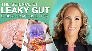 The Science of Leaky Gut  Everything You Need to know About Leaky Gut [upl. by Sheelagh]