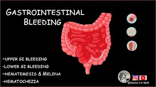 Gastrointestinal Bleeding  Medical Lecture  Doctor S A Wolf [upl. by Neelyt50]