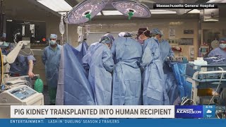 First genetically modified pig kidney transplanted into human recipient [upl. by Eitsirhc]