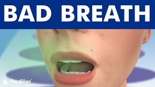 Bad Breath  Halitosis causes and treatment © [upl. by Aninnaig]