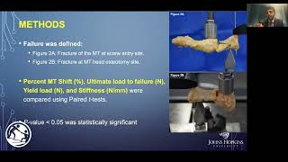 Minimally Invasive Hallux Valgus Correction A Biomechanical Comparison of Two Common Techniques [upl. by Oderfla]