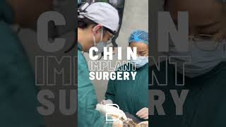 Chin augmentation goes beyond simple enhancement—it can also refine the lower third of the face [upl. by Oruasi]