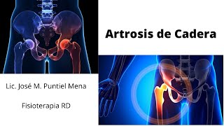 Rehabilitación en la Artrosis de Cadera Fisioterapia RD [upl. by Calandra89]