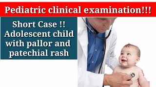 FCPS Pediatric clinical examination fcps shortcase cpsp paeds aplasticanemia fanconianemia [upl. by Urbannal]