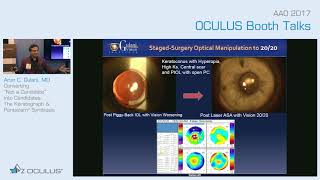 A Gulani The Keratograph amp Pentacam® symbiosis [upl. by Hedi]