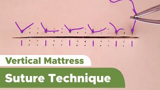 Suture Techniques and Training Series Interrupted Vertical Mattress Suture Technique [upl. by Hillard]