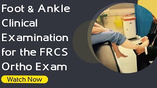 Foot amp Ankle Clinical Examination for the FRCS Ortho Exam  Orthopaedic Academy [upl. by Agace685]