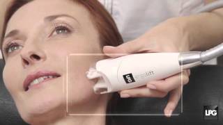 LPG Endermologie technology for the Face  Endermolift [upl. by Asor]