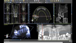 Tutorial 4 Blue sky plan en español Usando Modo Visualización [upl. by Nisotawulo288]