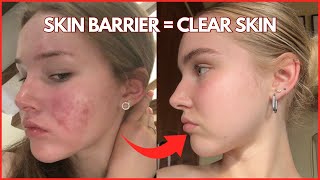 HEALTHY SKIN BARRIER  CLEAR SKIN  how to get one… [upl. by Yeslrahc]