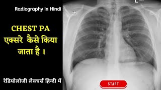 Chest Xray 2  Chest PA View Explained in Hindi radiographyinhindi xrayclasses xraytechnician [upl. by Ydnirb]