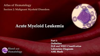 Acute Myeloid Leukemia AML  Part 1 [upl. by Neerroc]