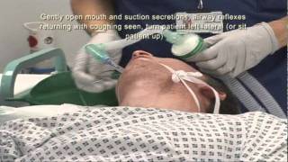 Intubation Extubation 67 [upl. by Janeta198]