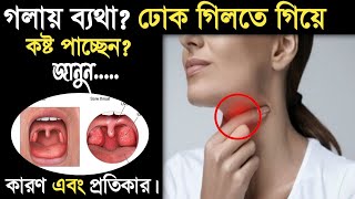 গলা ব্যথা দূর করার উপায়গলা ব্যথার ঘরোয়া উপায়What to do if sore throatGola betha dur korar upay [upl. by Burnard]