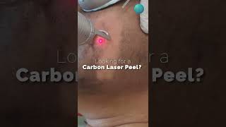 Looking for Carbon laser peel [upl. by Jo-Ann]