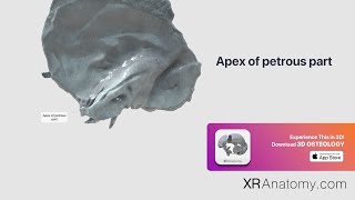 Temporal Bone  Apex of petrous part [upl. by Annamarie]