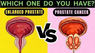 Symptoms Comparison BPH vs Prostate Cancer [upl. by Laeno611]