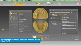 inLab SW 18 How to Convert a Sirona Connect Case That Contains Two Screw retained Crowns into a 3 U [upl. by Clougher]