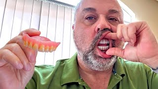 3 Things I Wish I Knew Before Switching From Dentures to Dental Implants [upl. by Bena]