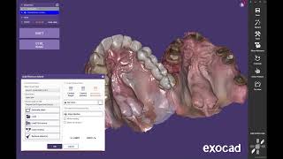 Aligning Multiple scans in Exocad [upl. by Vidda548]