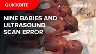 Nonuplets Why Halima Cissés Ultrasound sessions show Seven children instead of Nine [upl. by Boser280]