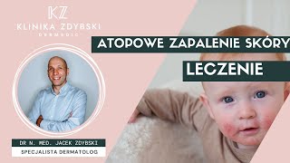 Dermatolog mówi o Atopowe Zapalenie Skóry  leczenie AZS [upl. by Caryl]