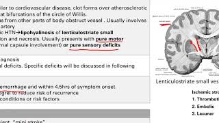 Cerebrovascular Disease  Nervous system  Step 1 Simplified [upl. by Hugues]