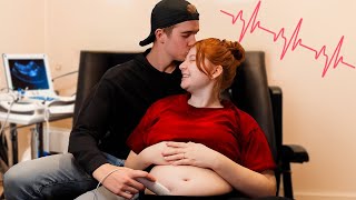 Hearing My Babys Heartbeat For The First Time 💕 [upl. by Peace]