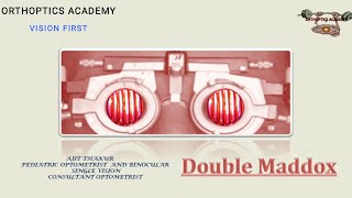 Double Maddox RodProcedures of double maddox rod Maddox Rod [upl. by Toth451]