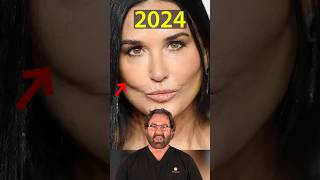 Demi Moore’s New Face 2024  Plastic Surgeon Reacts [upl. by Teria500]