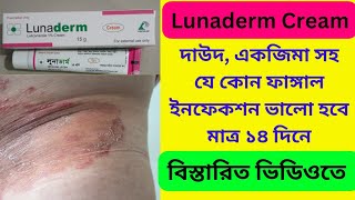 Lunaderm Luliconazole Cream Bangla  Lunaderm Cream এর কাজ কি ব্যবহারের নিয়ম কি [upl. by Reerg]