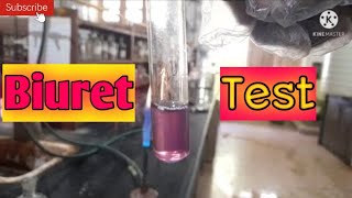 Biuret test  Confirmative Tests for Urea [upl. by Quirita832]