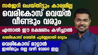 ഈ ഭക്ഷണം കഴിച്ചാൽ വെരികോസ് വെയ്ൻ പൂർണ്ണമായി മാറ്റാം varicose vein malayalam [upl. by Amersham]