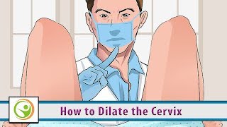 How to Dilate the Cervix [upl. by Ebenezer]