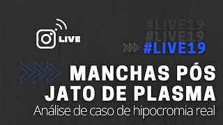 LIVE19  MANCHAS PÓS JATO DE PLASMA [upl. by Joli]