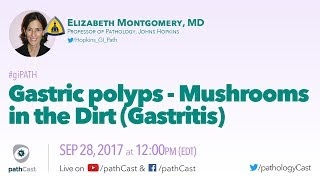 Gastric polyps  Mushrooms in the dirt GASTRITIS [upl. by Eelyme]