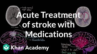 Acute treatment of stroke with medications  NCLEXRN  Khan Academy [upl. by Marden]