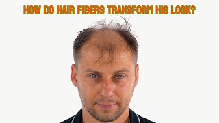 How do Hair Fibers Transform His Look [upl. by Alludba655]